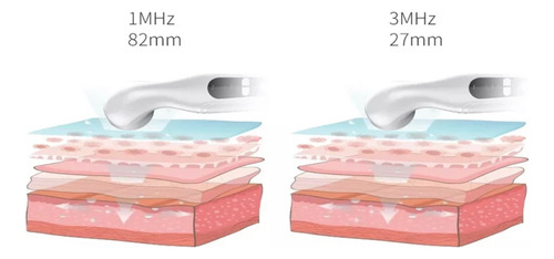 Ultrasonido Terapéutico Portátil Instrumento De Fisioterapia
