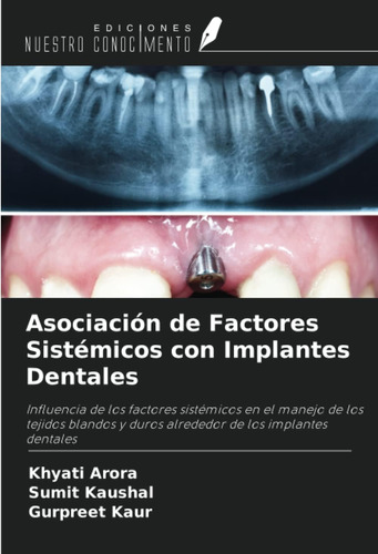 Libro: Asociación De Factores Sistémicos Con Implantes Denta