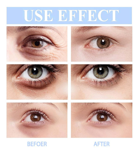 Q Retinol Que Fortalece Os Músculos Faciais Ve Moisturizing