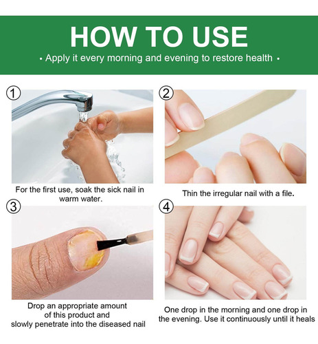 - Solución Contaminante Para El Cuidado De Las Uñas, 30 Ml
