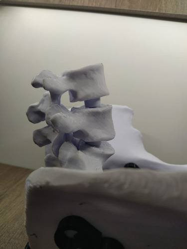 Pelvis Femenina Articulada Con Vertebra L4