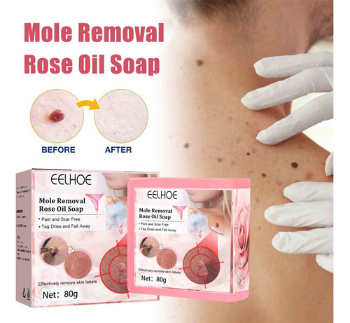 Para 3×jabón Removedor Verrugas Con Aceite Esencial Rosas