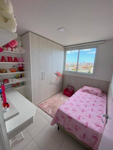 Apartamento Com 3 Dormitórios À Venda, 60 M² Por R$ 410.000,00 - Igra Sul - Torres/rs - Ap1456