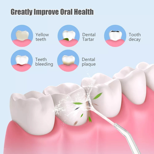 Imagen 5 de 10 de Irrigador Limpiador Dental Oral Bucal Y Brackets Uso Diario