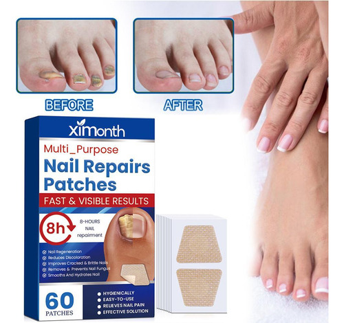Parches Reparadores De Uñas Extra Fuertes, 60 Unidades