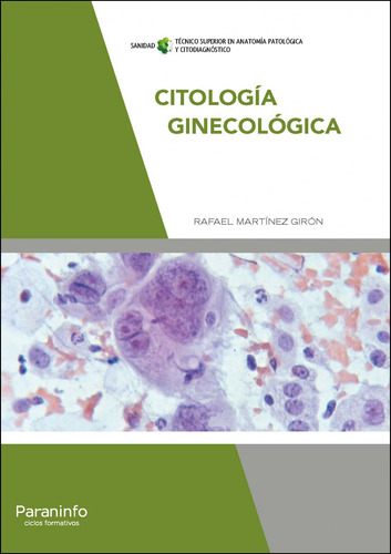 Citologia Ginecologica - Martinez Giron Rafael