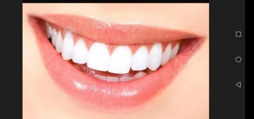 Imagen 1 de 1 de Reparaciones Dentales