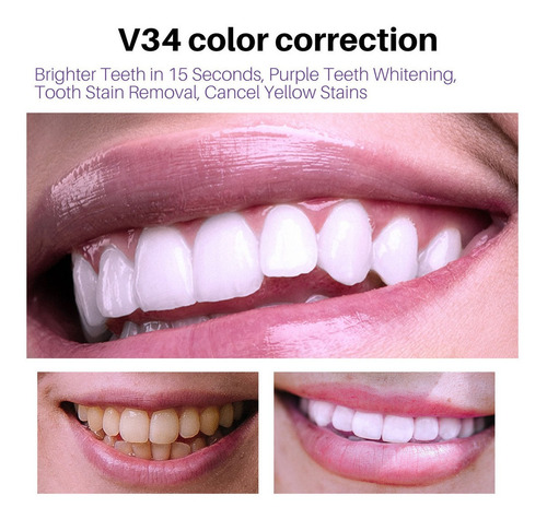 Imagen 9 de 9 de Kit De Blanqueamiento Dental Blanc Oral Care De 4 Unidades