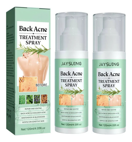 Cure A Acne Nas Costas, Cure A Acne Corporal Com Ácido × 2