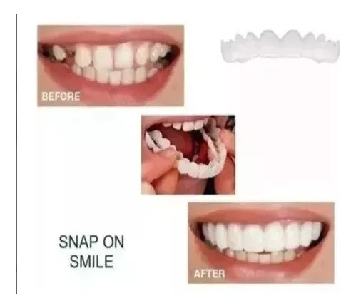 I Carillas De Dientes Postizos De Sonrisa Superior Inferior