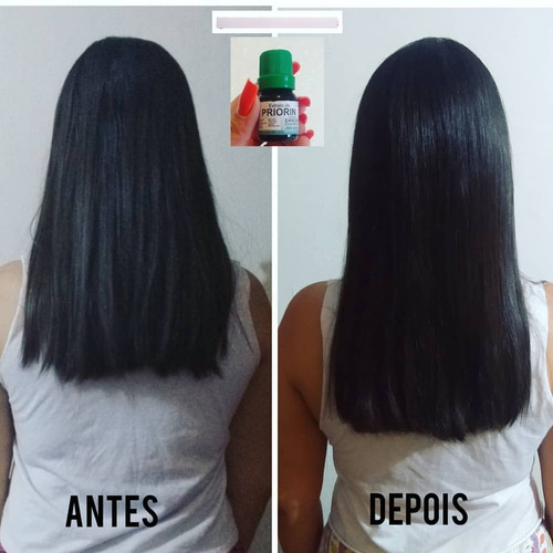 Shampoo Condicionador 2 Tônicos - Cresce Cabelo - Priorin