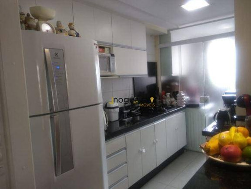 Apartamento Com 3 Dormitórios À Venda, 69 M² Por R$ 468.000,00 - Jardim Prudência - São Paulo/sp - Ap15405