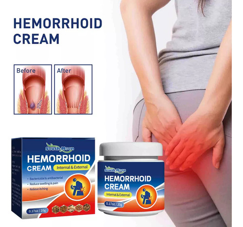 Hemorroides Mixtas Internas Y Externas Y Fisura Anal