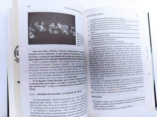 Libro Placa Neuro-mio Relajante Rubiano C. 173e2 (Usado)