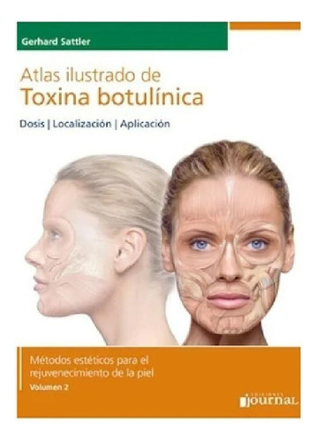 Libro - Atlas Ilustrado De Toxina Botulinica