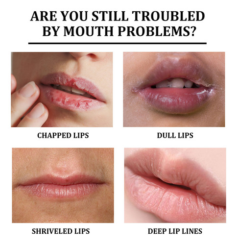 Bálsamo Exfoliante Aclarador De Labios, Hidratante Labial, U