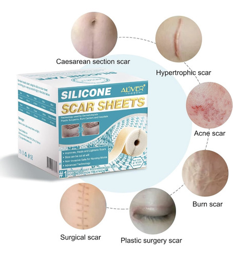 Parche Silicón Reutilizable Cicatrices Marcas Rollo 9 Metros