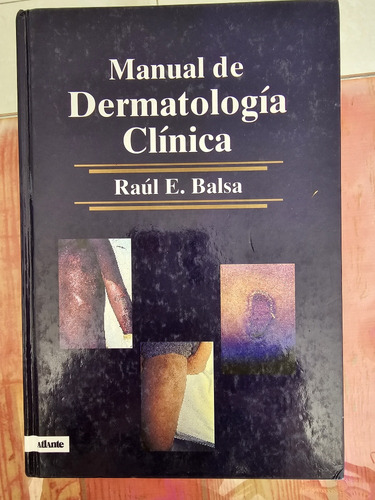 Manual De Dermatologia Clinica De Balsa 