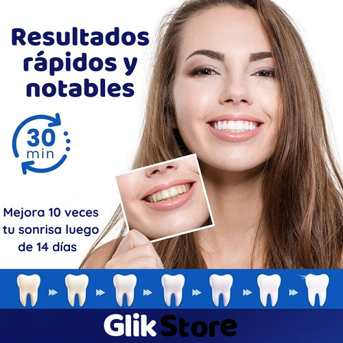 Cintas Blanqueadoras Dentales X28 Unidades Dientes Blancos