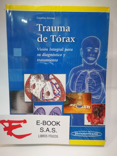 Trauma De Tórax ( Solo Nuevos Y Originales)