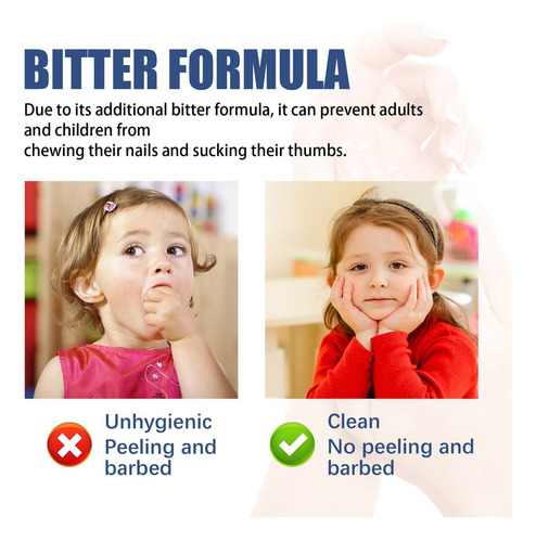 / D Prevenção De Roer As Unhas - Mastigar E Mastigar As