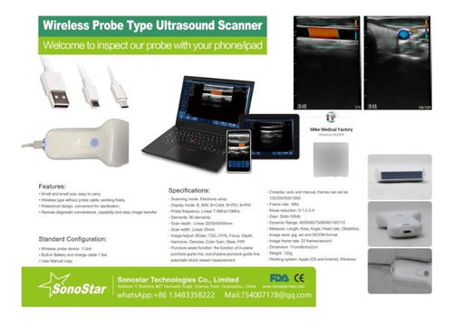 Ecógrafo Portátil Wifi/usb Lineal 7.5/10 Sonostar Oferta