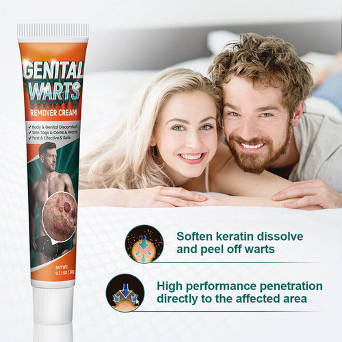 Xinnuo Pomada Para Eliminar Las Verrugas Del Herpes