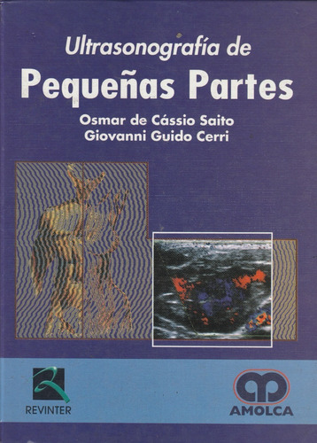 Ultrasonografía De Pequeñas Partes Cassio Amolca