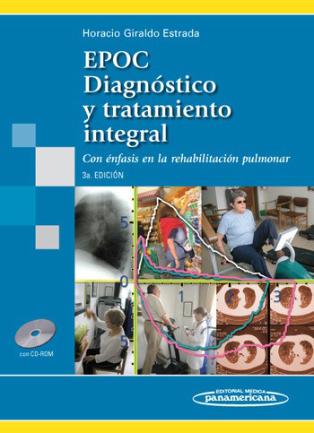 Epoc Diagnóstico Y Tratamiento Integral Con Énfasis En La Re