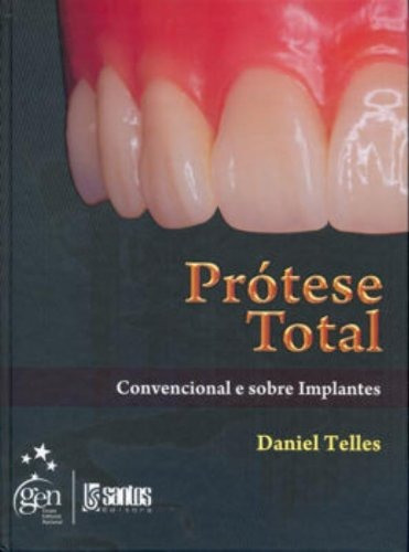 Prótese Total - Convencional e Sobre Implantes, de Telles. Livraria Santos Editora Comércio e Importação Ltda., capa dura em português, 2009