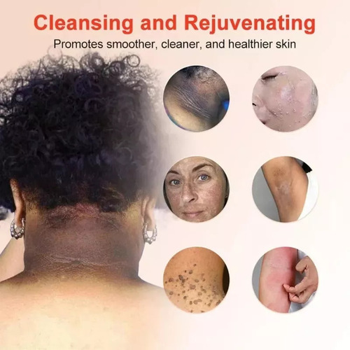 El Gel Exfoliante Ouhoe Limpia Suavemente La Piel, Reduce Lo