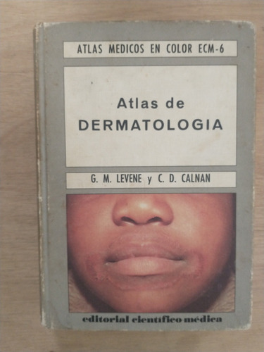 Atlas De Dermatología - G. M. Levene Y C. D. Calnan