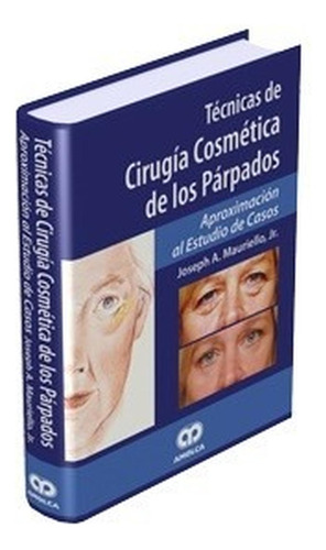 Técnicas De Cirugía Cosmética De Los Párpados