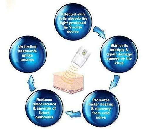 Virulite Aprobado Por La Fda Invisible Dolor De Luz Electrón