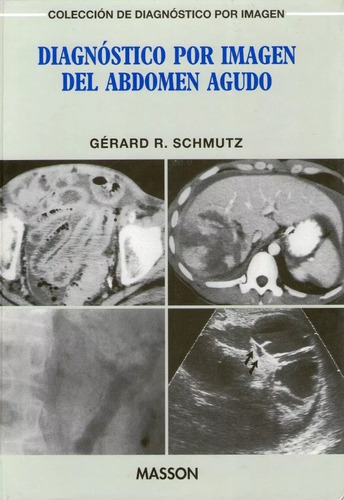 Diagnostico Por Imagen Del Abdomen Agudo  -  Schmutz