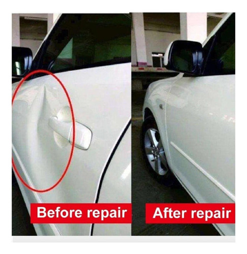 Herramienta Con Ventosas Para Reparar Abolladuras De Coche