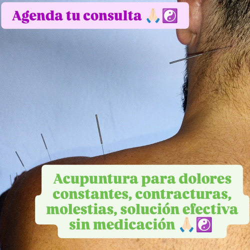 Acupuntura Y Quiropraxia