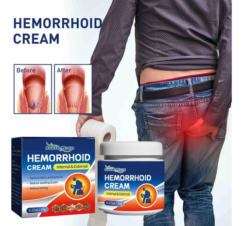 Hemorroides Mixtas Internas Y Externas Y Fisura Anal