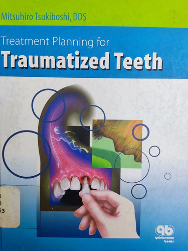 Libro Treatment Planning Traumatized Teeth Tsukiboshi 173h6