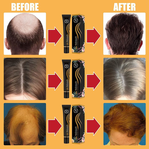 4 Unidades De Rolo De Serum Capilar Orgânico Regrowth Cresci