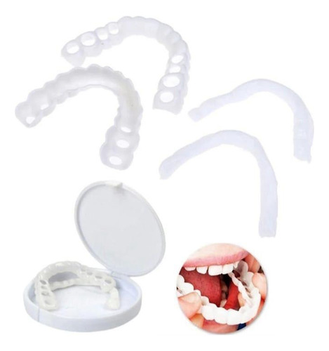 Lentes Snap On Smile Superior E Inferior (envio Imediato) (Usado)