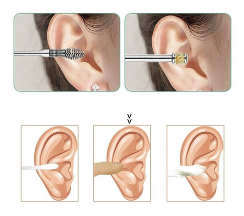 Imagen 9 de 10 de Herramientas Para Limpieza De Oídos Kit Quitar Cera Del Oído