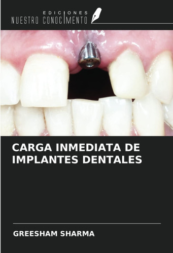 Libro: Carga Inmediata De Implantes Dentales (spanish Editio