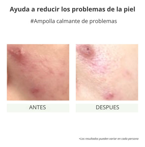 Ampolla Calmante Vegan Green Mild - Cosmética Coreana Vegana