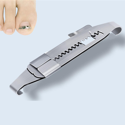 2 Uds Herramientas De Corrección De Uñas Encarnadas Clips