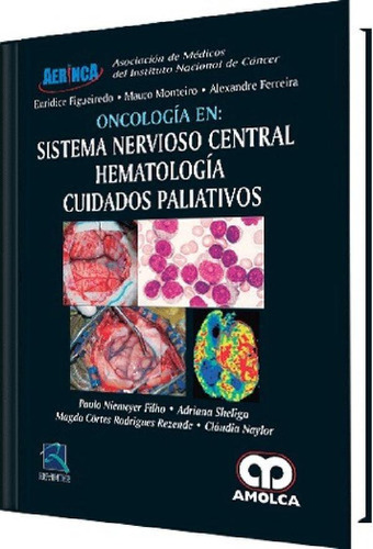 Libro - Oncología En Sistema Nervioso Central Hematología C