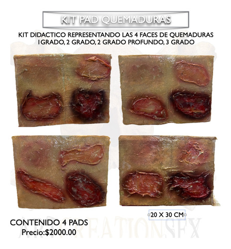 Pad Didáctico Quemaduras 1,2,2.5,3 Grados Kit 4 Pads