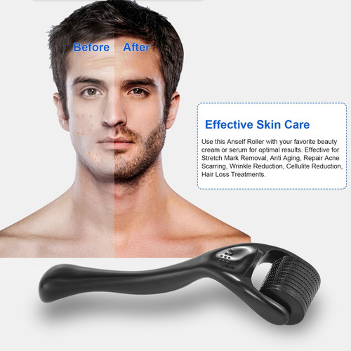 540 Derma Roller - Rodillo Para Barba (0,25 Mm, Titanio)