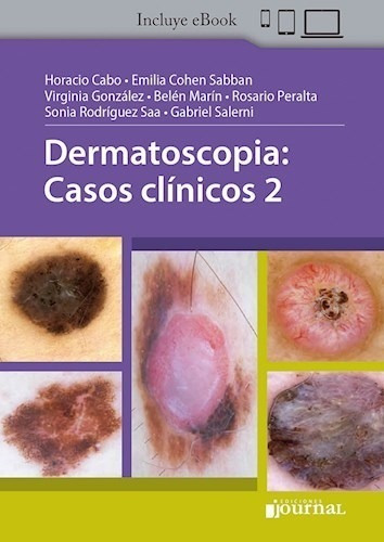 Dermastocopia: Casos Clínicos 2 - Cabo