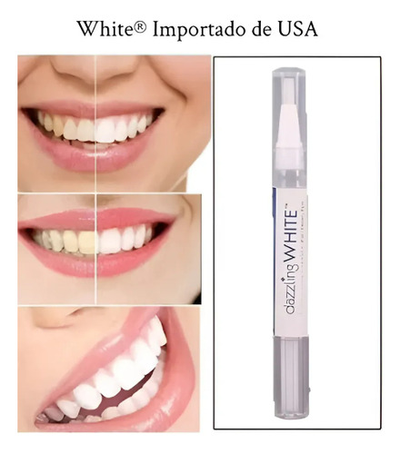 Blanqueador Dental Lápiz De Blanqueamiento De Dientes